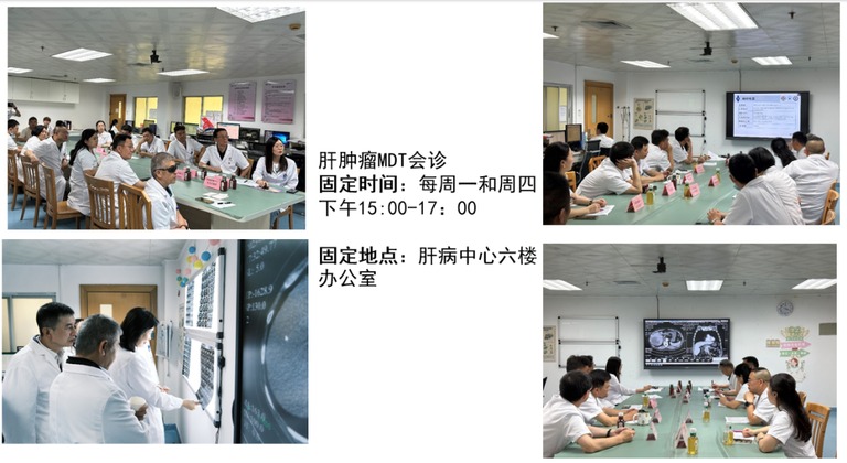 肝肿瘤MDT会诊的固定时间与地点